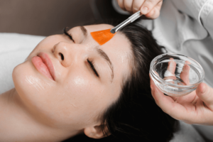 woman getting chemical peel at aesthetic clinic in Radlett